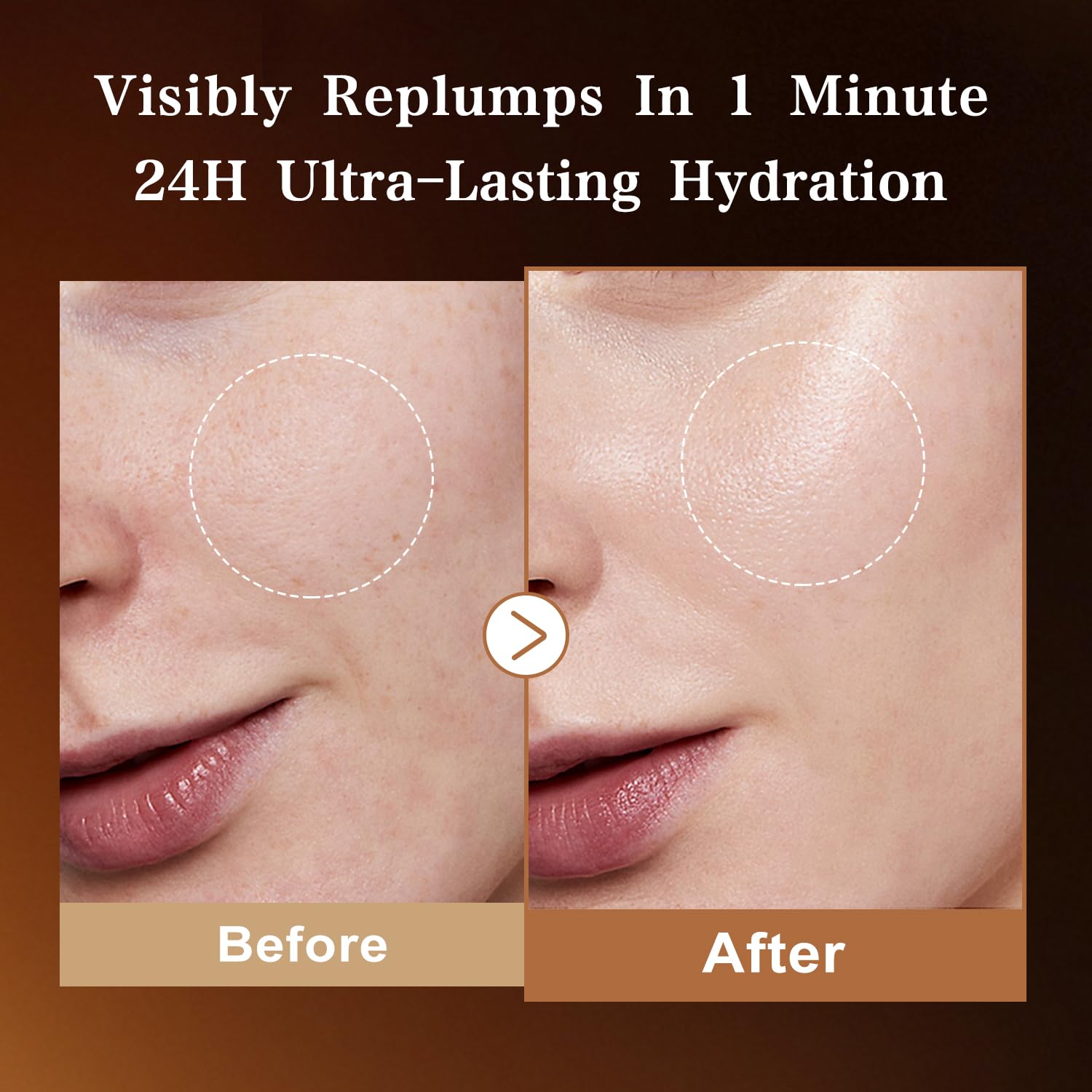 Hyaluronic Acid Serum with 8 HA Forms + Matrixyl 3000 — 30 Single-Use Vials — Image 4